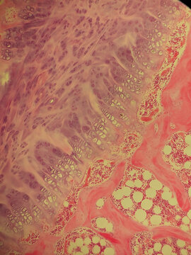 Fibrocartilage Tissue Histology Section Hematoxylin Eosin Stain