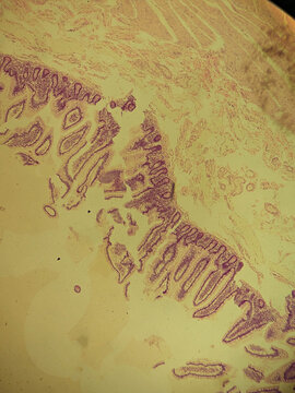 Human Stomach Wall Histology Section Showing Gastric Folds