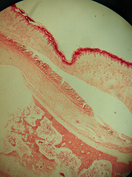 Stratified Squamous Epithelium Keratinized Tissue Histology Light