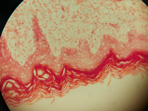 Stratified Squamous Epithelium Keratinized Tissue Histology Light