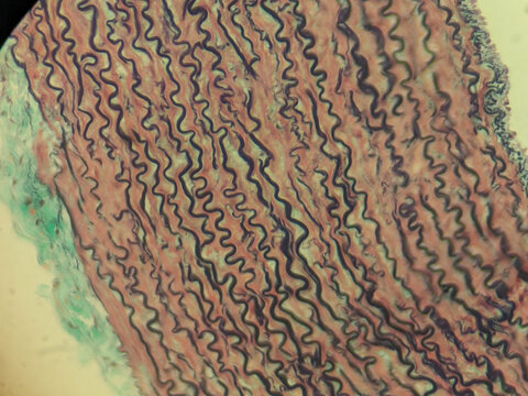 Aorta Large Artery Cross Section Histology Showing Tunica Layers