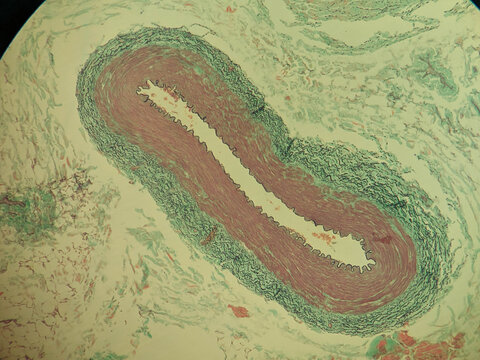 Muscular Artery Cross Section Verhoeff Van Gieson Elastic Stain Histology M