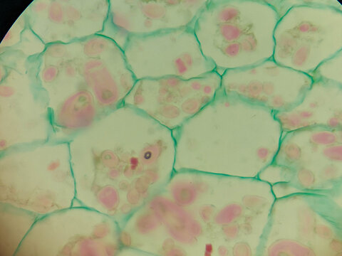 Synchytrium endobioticum Infected Plant Cells Sporangium Zoosporangia