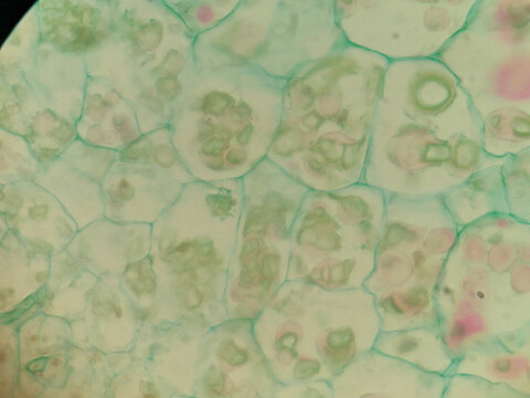Synchytrium endobioticum Infected Plant Cells Sporangium Zoosporangia