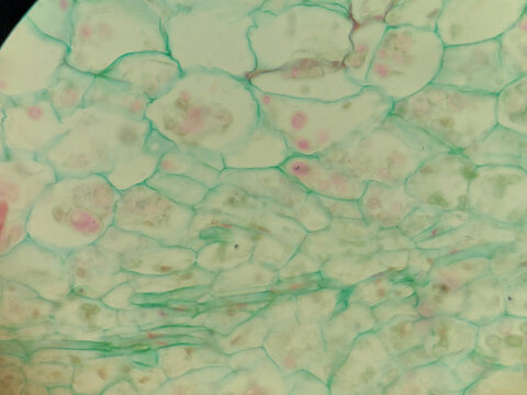 Synchytrium endobioticum Infected Plant Cells Sporangium Zoosporangia