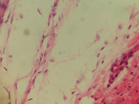 Pseudostratified Ciliated Columnar Epithelium Human Respiratory Tract Histology