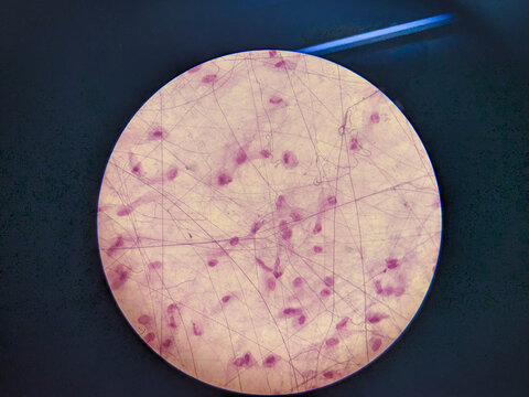 "Areolar Tissue" Images – Browse 81 Stock Photos, Vectors, and Video ...