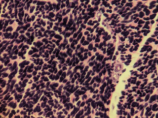 Obraz premium Elastic Tissue Fibers Longitudinal Section Verhoeff Stain Histology