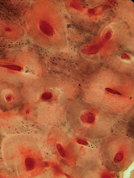 Bone Tissue Osteocytes Lacunae Canaliculi Ground Section