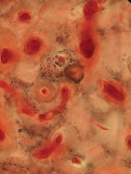 Bone Tissue Osteocytes Lacunae Canaliculi Ground Section