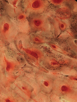 Bone Tissue Osteocytes Lacunae Canaliculi Ground Section