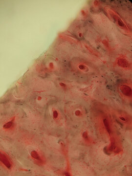 Bone Tissue Osteocytes Lacunae Canaliculi Ground Section
