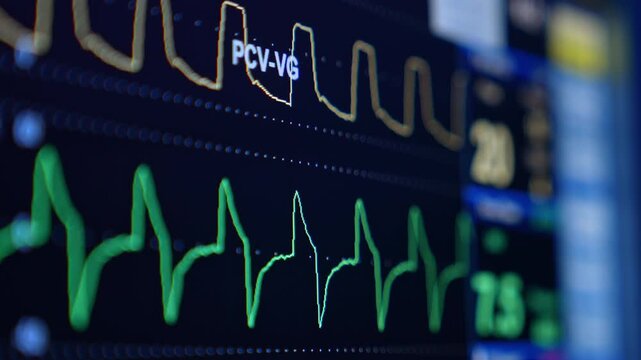 Interface of the modern device displaying the patient's life signs. Vital parameters tracking during the surgery. Close up.