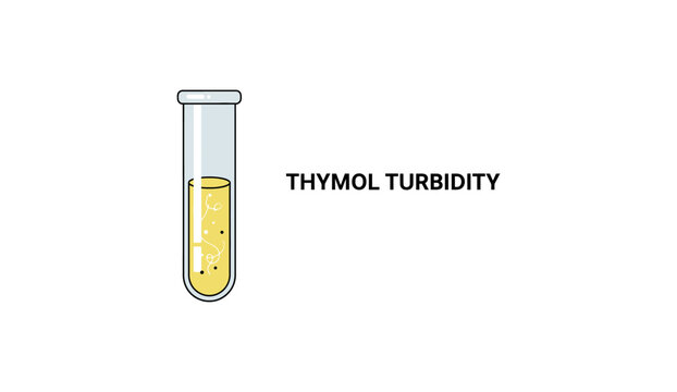 Vector illustration of a test tube containing a cloudy yellow liquid with text "THYMOL TURBIDITY", representing a medical laboratory test.