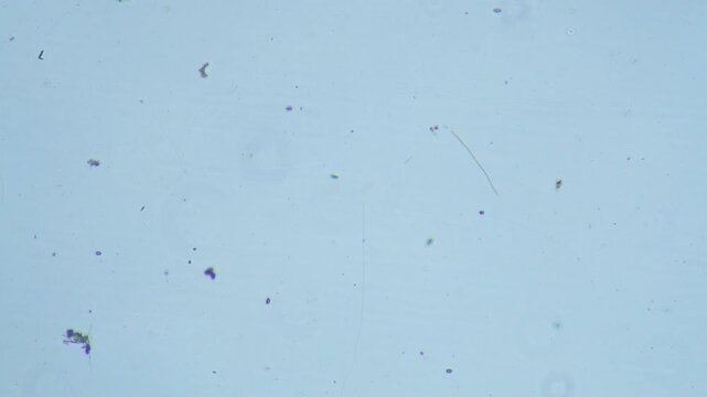Protozoa microorganism cell movement under light microscope representing aquatic protozoology study and live evolutionary biology research in 4K Ultra HD footage