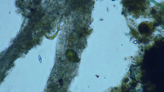 Protozoa microorganism cell movement under light microscope representing aquatic protozoology study and live evolutionary biology research in 4K Ultra HD footage