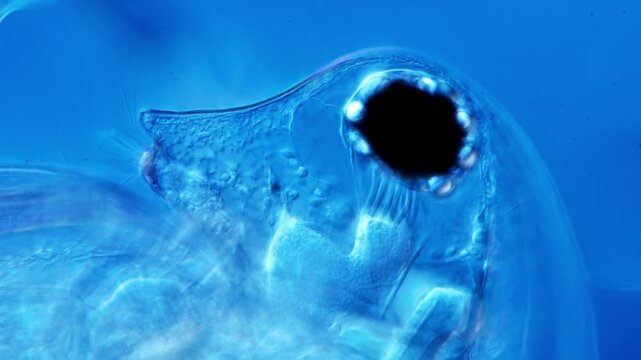 Microorganism under a microscope visualization representing point of care pathogen diagnostics and cellular microbiology laboratory biosensors research in 4K Ultra HD footage
