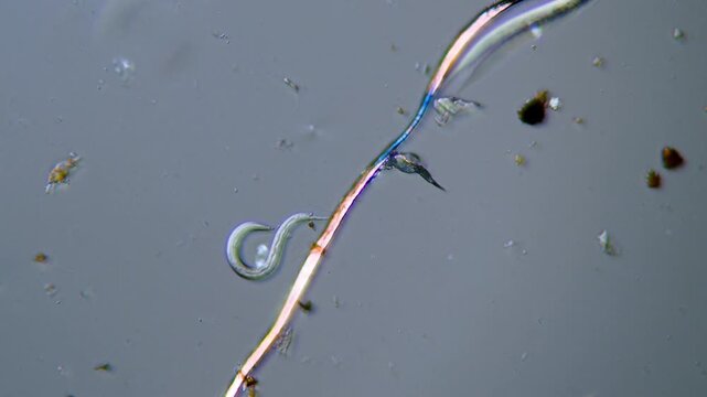 Nematode worm microorganism in soil sample under light microscope representing plant parasitic pest threat and agro-ecosystem bio-indicator research in 4K Ultra HD footage

