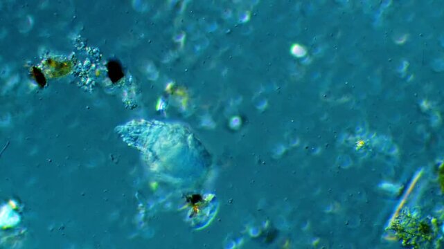 Rotifer microscopic organism activity under light microscope representing microbial loop nutrient cycling and freshwater micro-invertebrate anatomy research in 4K Ultra HD footage
