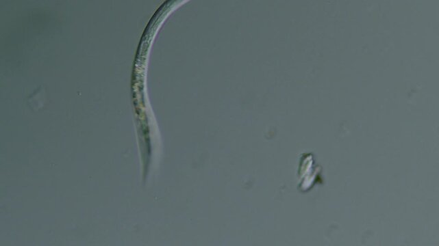 Nematode worm microorganism interaction under light microscope representing environmental stress response and genomic sequencing biology research in 4K Ultra HD footage
