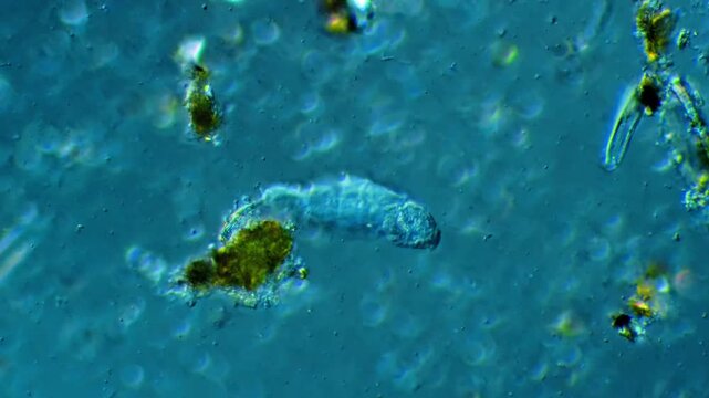 Rotifer microscopic organism locomotion under light microscope representing zooplankton physiology and micro aquatic biogeochemistry research in 4K Ultra HD footage
