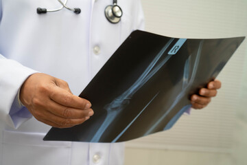 Naklejka premium Doctor examining knee joint bone radiography xray film.