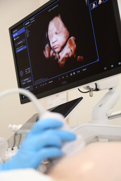 A modern ultrasound machine. An ultrasound examination of a pregnant woman. An ultrasound machine with AI. A woman undergoing a fetal ultrasound.