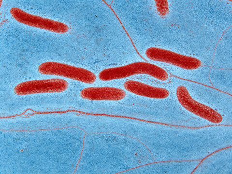 Micrographs of Zyer-Nilsen staining of Mycobacterium leprae, red acid-fast bacilli in nerve tissue, against a natural blue background.
