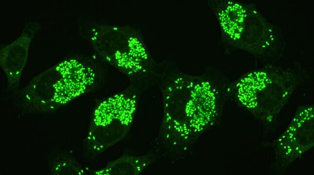 Coxiella Burnetii Phase I Phase II Antigenic Variation IF Test. Coxiella burnetii immunofluorescence test showing bright green intracellular organisms within Vero cell in IFA diagnostic test.