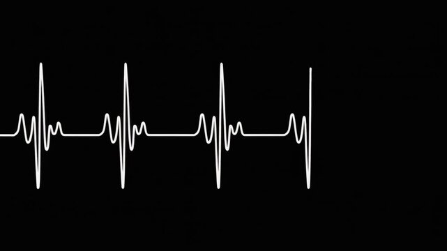 Animated heartbeat line on a black background, medical concept, health, life, pulse, rhythm