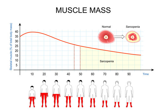 Sarcopenia and age-related muscle loss. Aging anatomy, longitudinal chart of skeletal muscle degeneration