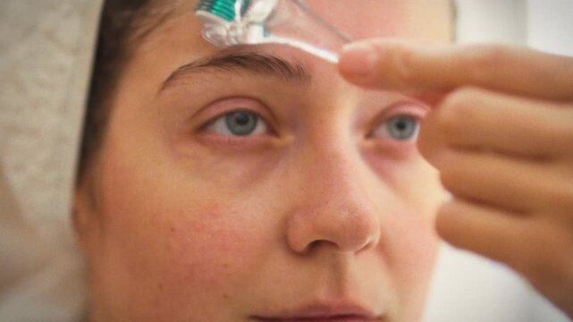In home spa, young woman rolls a derma roller with microneedles across her face, delivering a facial massage that stimulates skin, enhancing tone and condition as part of modern skincare rejuvenation