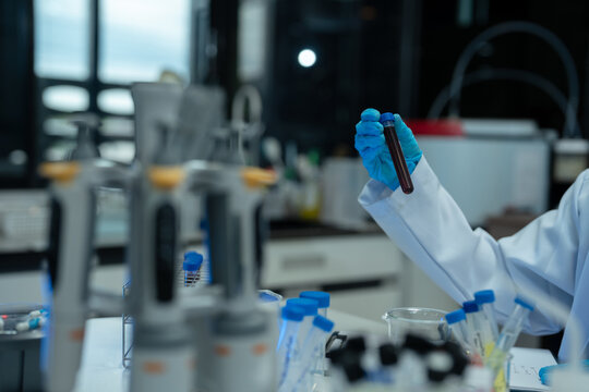 Lab work, Doctor holds a test tube takes the test from a test tube in analysis, blood, DNA, test tube stand.