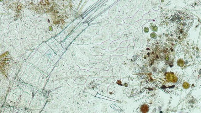 Peritrich ciliate at 10x under brightfield microscopy