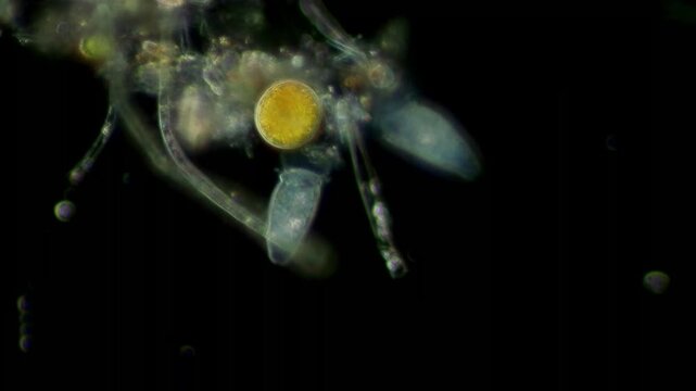 Peritrich ciliate at 20x under darkfield microscopy