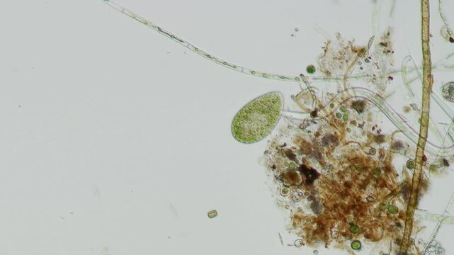 Paramecium and nematode at 10x under brightfield microscopy