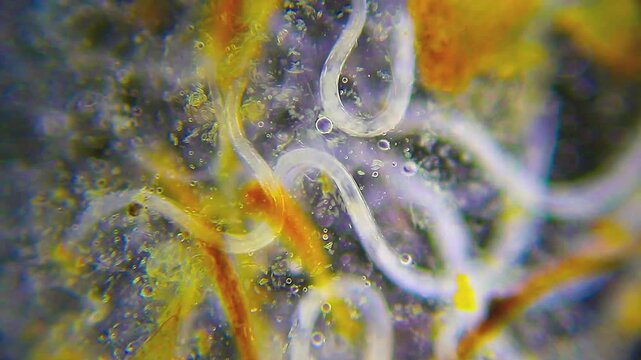 Microscopic view of a cluster of nematode worms intertwined in a water drop under 100x darkfield magnification