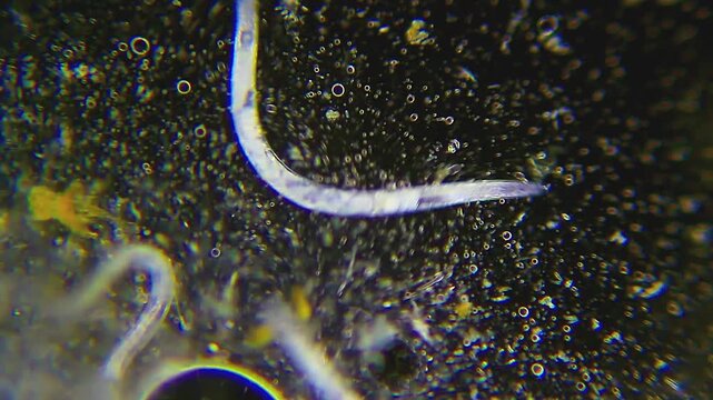 Nematode roundworms moving through soapy fluid under 100x darkfield magnification