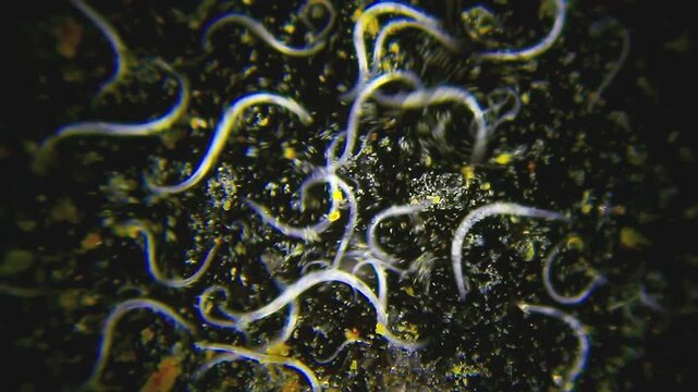 Active nematode worms moving in a water drop under 40x darkfield magnification