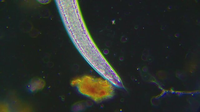 Microscopic view of nematode worm tail section in motion under darkfield 400x magnification