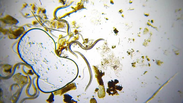 Microscopic view of a cluster of nematode worms in a water droplet under 40x magnification brightfield