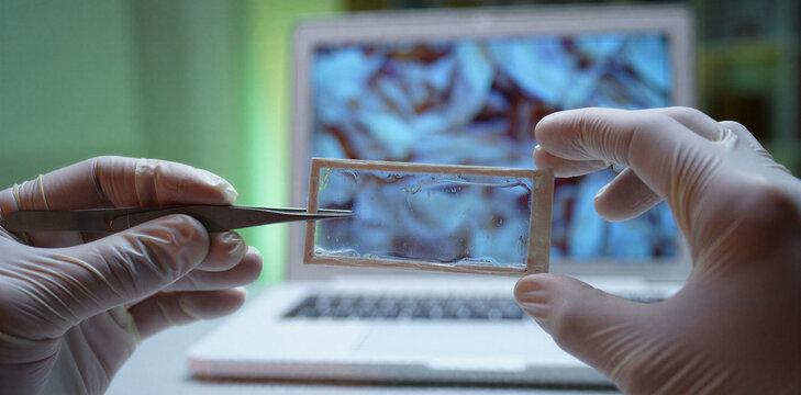 Close-up of laboratory technician hands in protective gloves using tweezers to handle a microscope slide sample with cellular images visible on a computer screen laboratory tweezers research