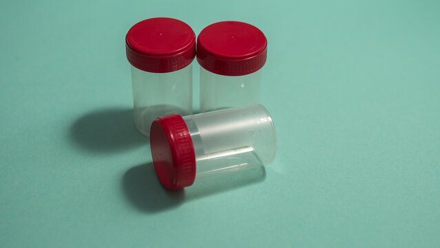 Three sterile medical specimen containers with red lids on blue background