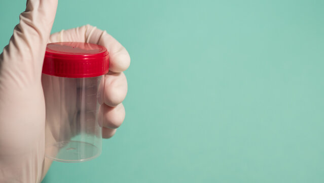 Gloved Hand Holding Empty Specimen Container with Red Cap &mdash; Medical Sample Collection Concept with Copy Space