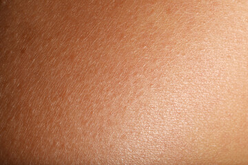 Fototapeta premium Texture of normal skin as background, closeup