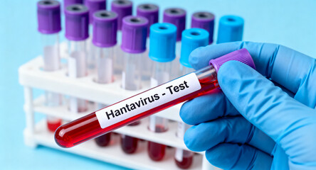 Fototapeta premium Close-up of a gloved hand holding a test tube labeled Hantavirus - Test, with a rack of similar tubes in the background