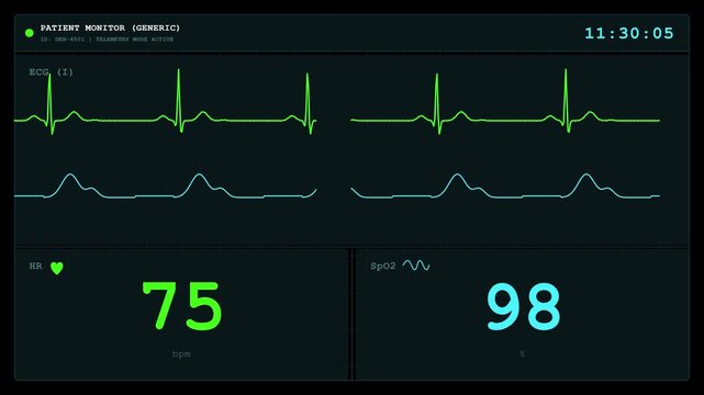 Animation of a patient monitor screen displaying vital signs with alpha channel for medical overlay