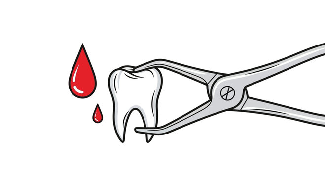 Tooth Extraction With Forceps and Blood Drops