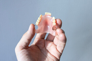 A man holds a partial removable upper jaw prosthesis in his hand. © Andriy