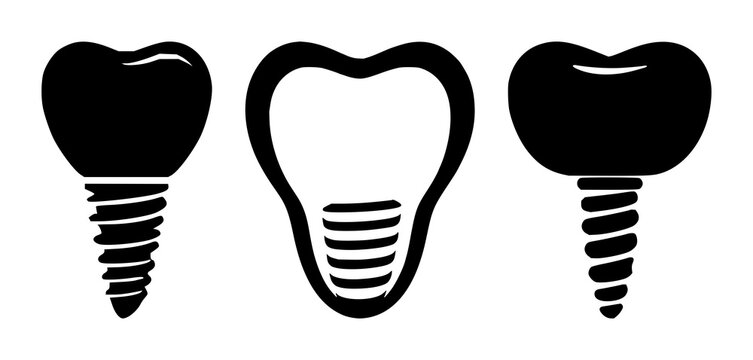 Dental implant tooth icon set with solid black icon on white background featuring dental, implant, tooth with iconography and white backdrop